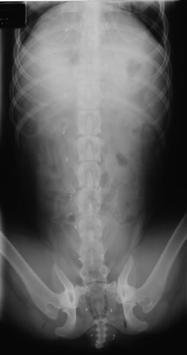 X-ray of Korie's Beads